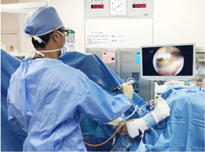 関節鏡視下手術の様子