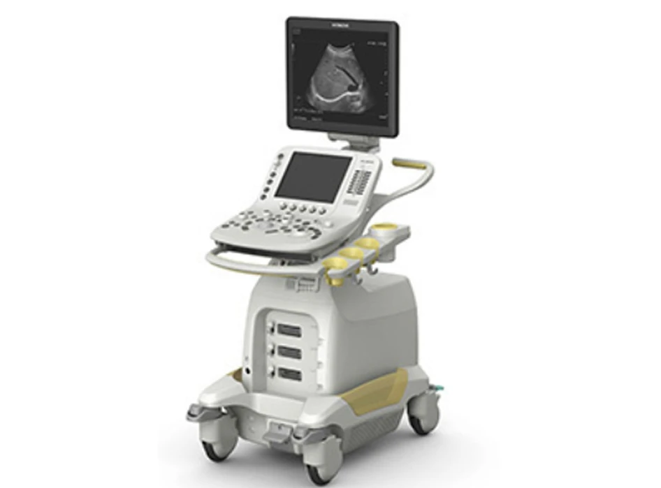 超音波検査装置（日立アロカ製）