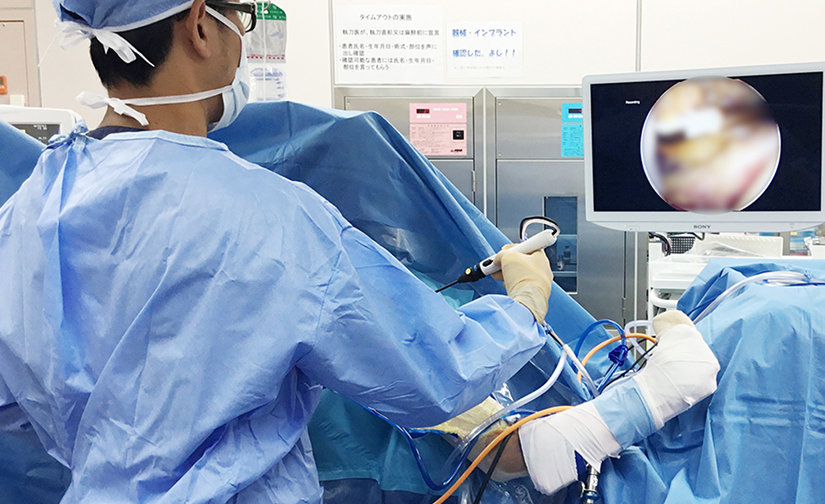 関節鏡手術の様子